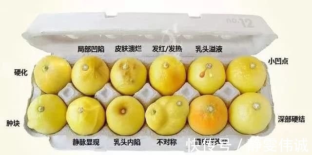 人工流产|22岁女孩确诊“乳腺癌”,医生说出病因,母亲痛哭都是男人害得