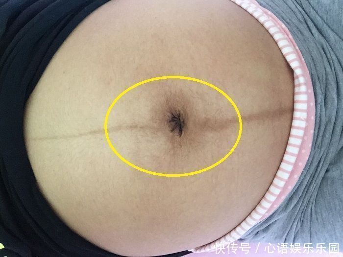 眼儿|女性怀孕后,肚脐眼是凸起是凹进,受3个因素影响,别轻易忽视