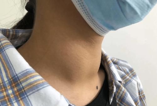 人体|各个医院联合声明：1“粗粮”尽快停止食用，容易加速甲状腺病变，趁早扔掉