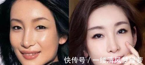 中国人|双眼皮现在还流行吗,你到底适不适合双眼皮,一起了解一下吧