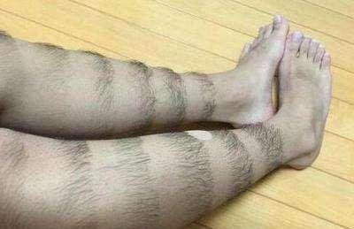 腿毛|为啥有的女生体毛旺盛,而有的“光秃秃”?哪种更健康?不妨了解