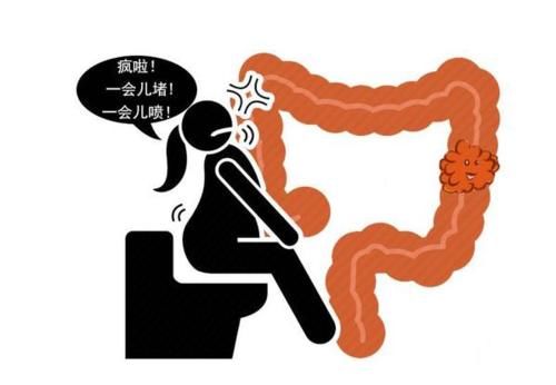 癌肿|晨起一个症状，可能是肠癌“征兆”，很多人都忽视了！
