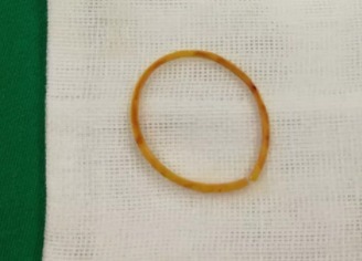 爷爷奶奶|4岁女孩总喊手臂疼,送到医院检查后,医生再晚就来不及了