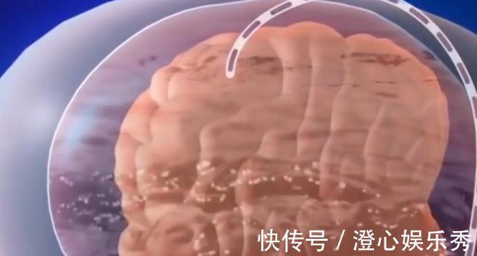 治疗|3岁女童头重达20斤,手术刚要进行,家人却放弃治疗准备寿衣