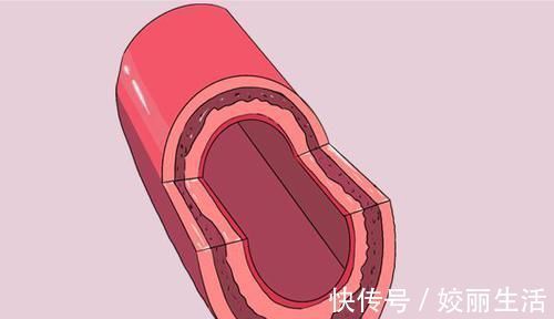 胡子|男人雄激素不足，身体会有哪些表现？若不及时补足，会怎么样？