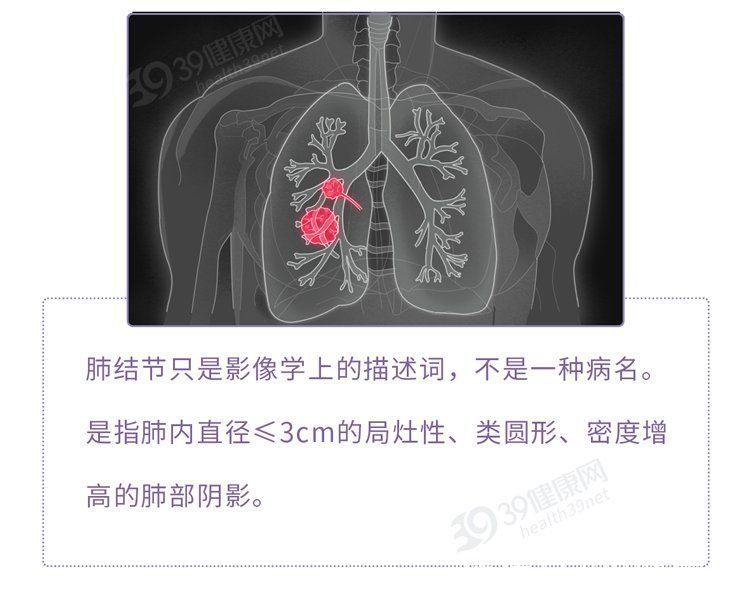 恶性|磨玻璃肺结节是肺癌吗？恶性不取决于大小，这2种尤其要当心