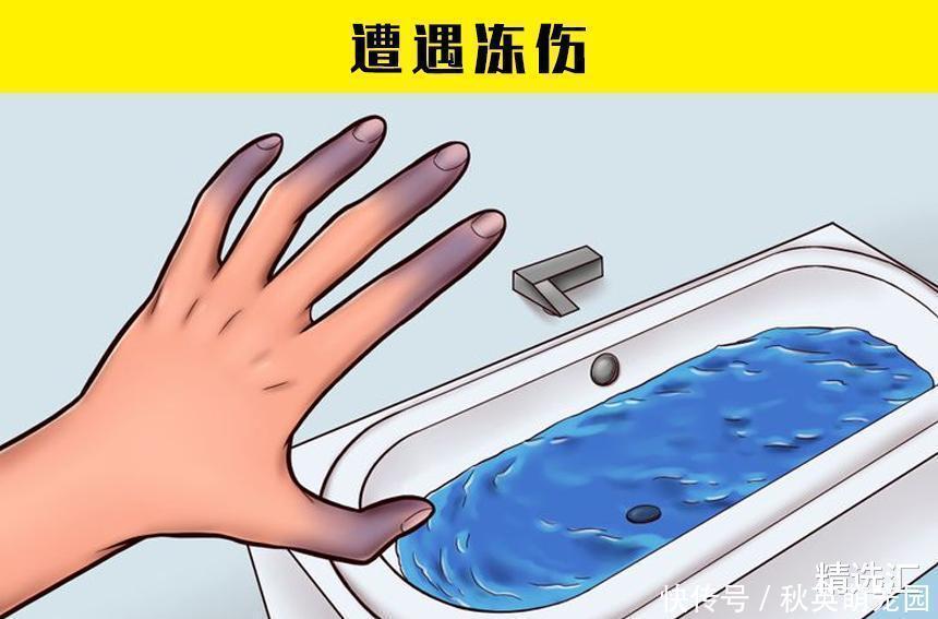 毒蘑菇|在紧急情况下，或许可以拯救生命的7个小技巧