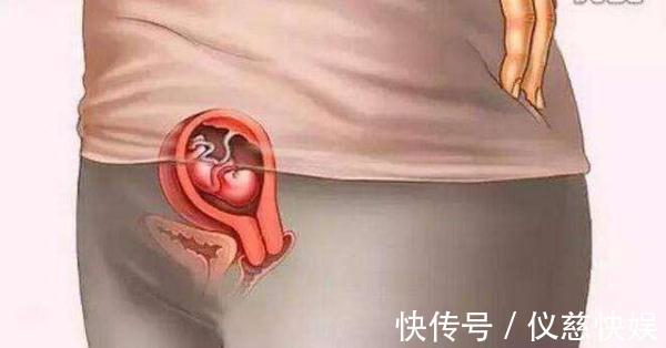 剧烈运动|怀胎十月到底是什么样的,十张图带你看孕育过程,生而为人须了解