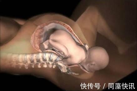 分娩|二胎孕妈路上羊水破了,陌生小伙机智接生,预产期孕妇应知道这些