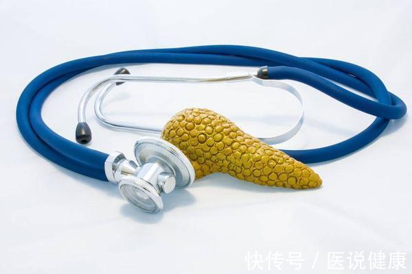 征兆|胰腺癌突然来袭?医生:身体4个“异常”,或是胰腺癌的征兆