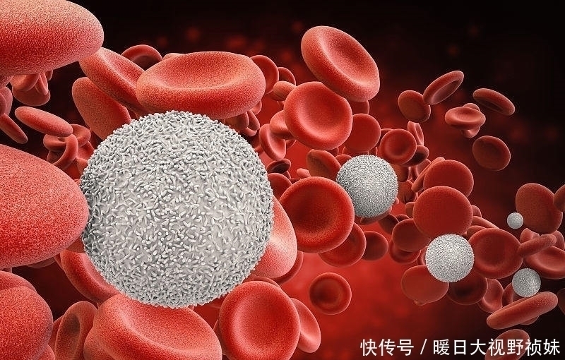 血脂|血脂高者吃这些食物“加速”脑梗发作,尤其是第二种,再馋也别碰