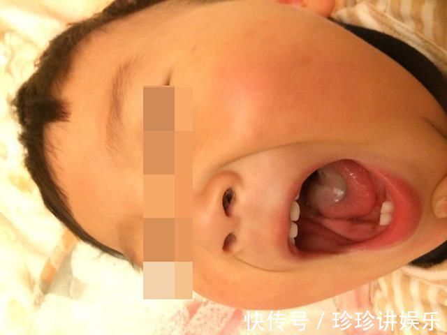 皮皮|孩子积食，身体会发出五个信号，中招的父母快停手，别再喂娃多吃