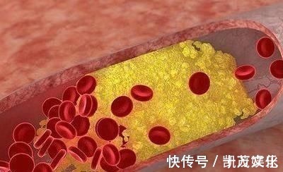 腰椎间盘突出|寿命长不长,身体3出有无“异常”,若你一个也没有恭喜你长寿