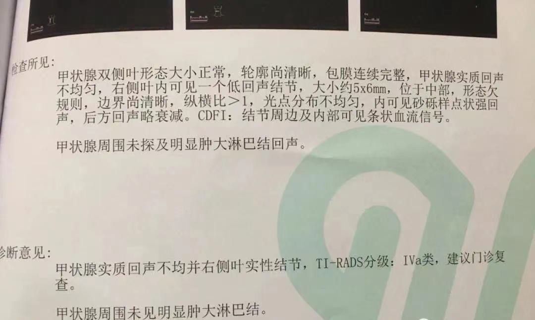 甲状腺癌|46岁女子,确诊甲状腺癌,医生惋惜:2件事怎么能常做,太无知