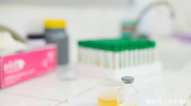 前列腺|男人晨起“第一次小便”,若没这3种表现,可能肾脏很强壮!