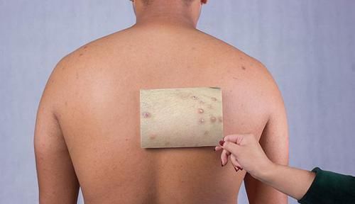 祛湿|湿气到底是怎么来的洗澡会加重体内湿气如何有效祛湿