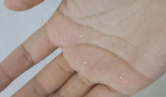 阴虚体质|动不动就出汗和不出汗的人,哪种人的“体质”更好呢?你清楚吗?