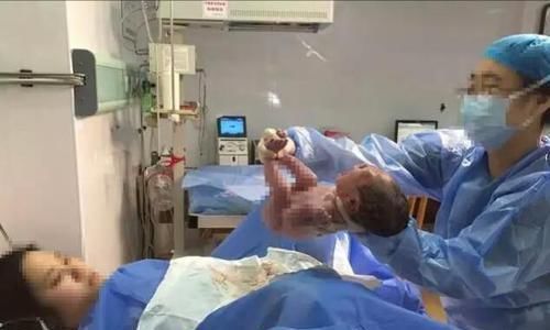 初产妇|很多医院让男医生接生,不会引起产妇反感吗?不妨听听医生的解释