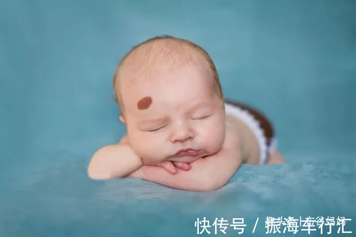 孕期|胎记是怎么来的?产科医生:孕期要避开3种行为,以免宝宝长胎记