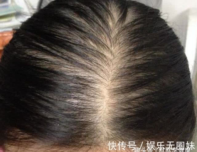 九蒸九|秋天做好这3点,把阳气收得紧紧实实,整个冬天不亏虚!