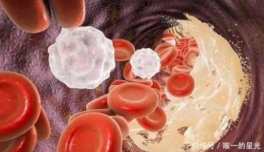 维生素A|气血是让人的根本,补气血才能养生,4种食物补气佳