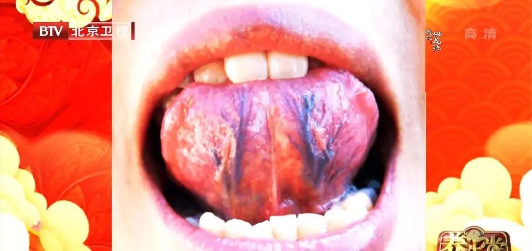 维生素e|天然血管清道夫，老中医早餐吃它50年，血管干净，心脏如小年轻！