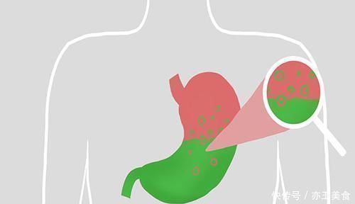 天天咳嗽,做肺部CT又显示正常,是什么原因答案告诉你