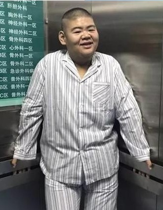 体能|他是中国第一胖子，重668斤，为爱减掉400斤，如今怎样了