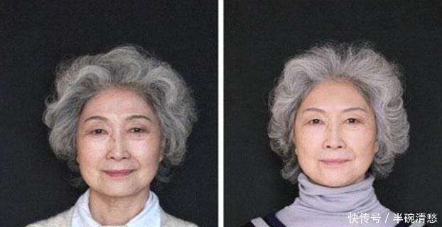 医美医院|那些打过“玻尿酸”的人,容貌会有什么变化还好及时知道了!