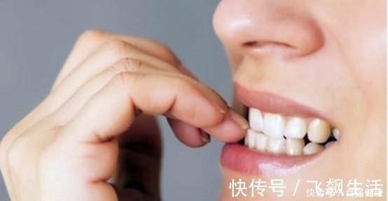 苦甲|啃指甲成了习惯怎么办,该怎样解决咬指甲这个问题?