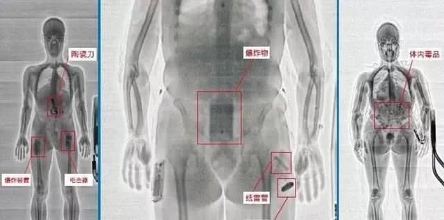 部位|女性在过安检时，隐私部位会暴露在显示器上吗说出来你也许不信