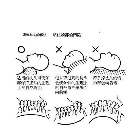 頸椎|3個治療頸椎病的方法，頸椎不暈，頭不疼，可以減輕癥狀
