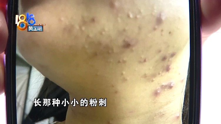 护肤品|脸上“有点扎手”，“中草集”要证据