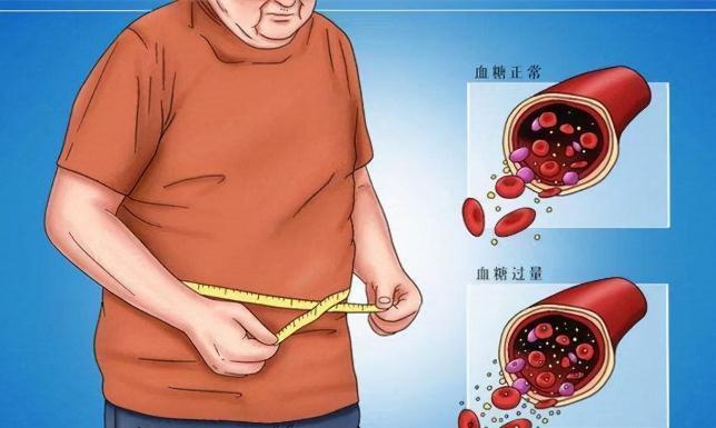 生活方式|从起病到死亡，得了糖尿病是怎样一种体验？