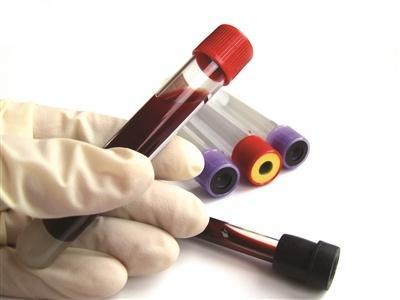 高血压患者|高血压患者走路锻炼,走六千步与一万步的效果有多大一起了解下