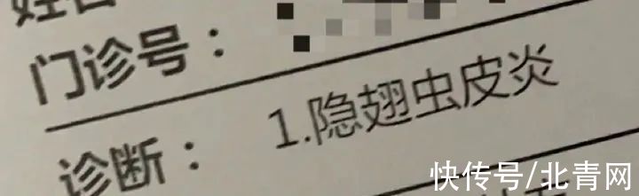 隐翅虫皮炎|遇到这种虫千万别拍死