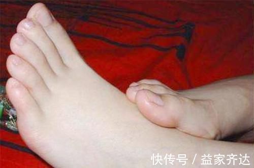 脚趾|脚是长寿的“敲门砖”,脚上若有这4“迹象”,轻松活到100岁