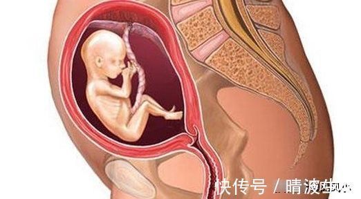 怀孕|怀孕17周，孕妇摸到肚子里有硬东西，别想多了，有这3种可能性