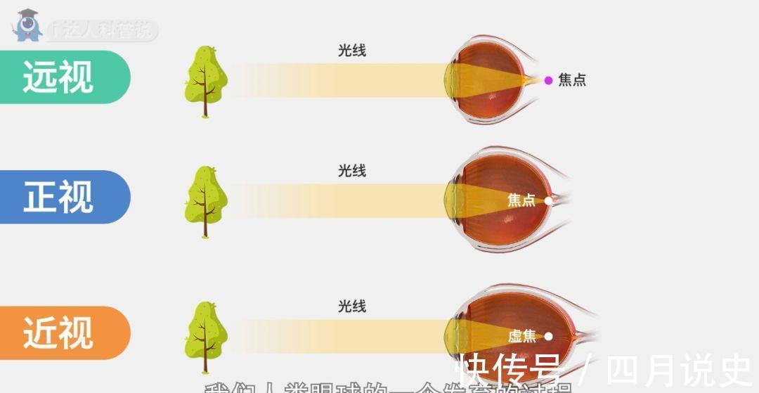 近视|科普｜眼轴长度评估在近视防控中的重要作用！