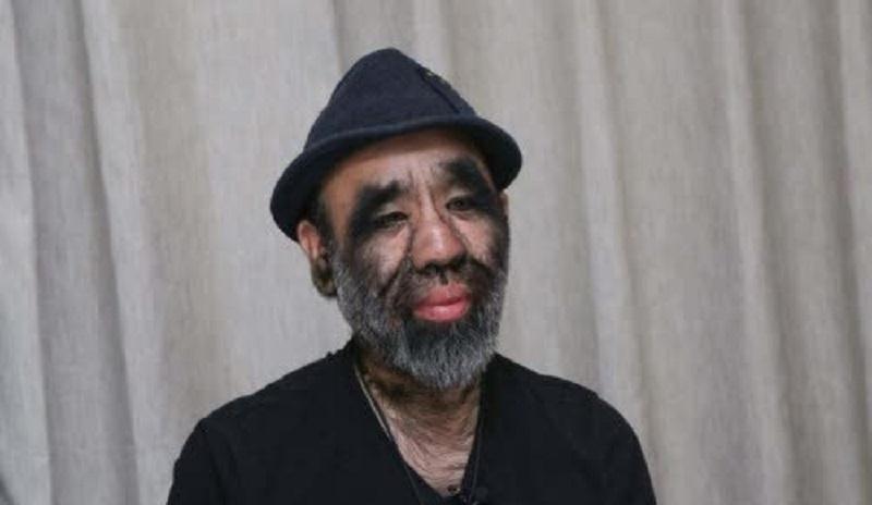 还记得曾轰动一时的毛孩于震寰吗?44年