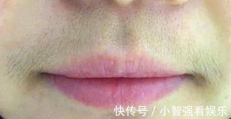 衰老|女性开始衰老的时候,脸部或有这几个表现,快来了解一下吧