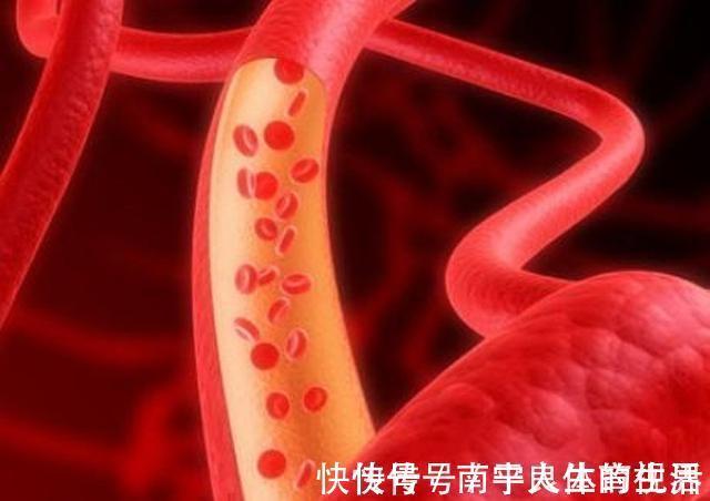 长期服用|长期服用降压药,血管是否会越来越硬?应当配点什么药软化血管?