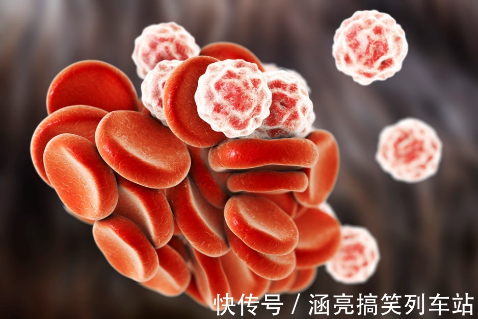 膽固醇|改善高血脂其實可以不用吃藥，醫生提出2條實用建議，比藥強多了