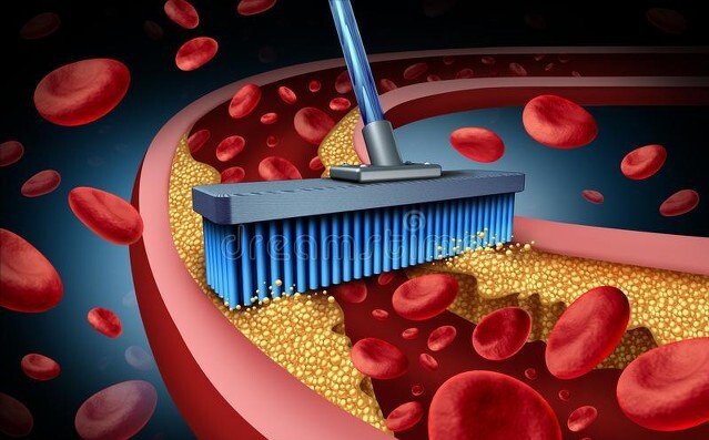 净化|2个中成药，化浊降脂、净化血液、恢复血管弹性，标本兼治高血压