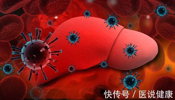 肺癌|这4类恶性肿瘤易高发,来临前有哪些症状表现,了解后,需重视