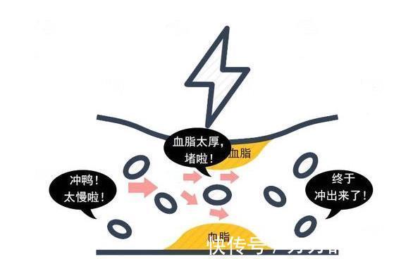 保护血管|血脂一高,全身遭殃?牢记2种食材,没事敞开吃,降低胆固醇