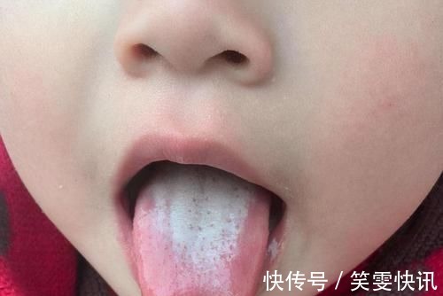 脾胃|积食多是“拖”出来的,孩子身体出现3种异常,或是脾胃受损信号