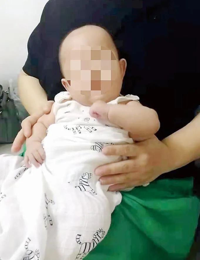 月月|奇迹！出生时体重才一斤多！“迷你宝宝”闯过重重难关