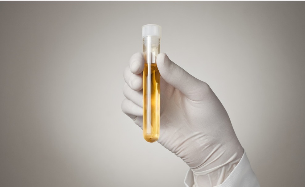 水杨酸|身体有这6个特征，说明你特别健康，容易长寿，特别是40岁以后！