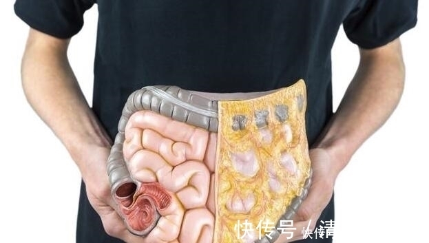 魔芋粉|经常便秘,拉不出、拉不净,1个简单对策让排泄变顺畅